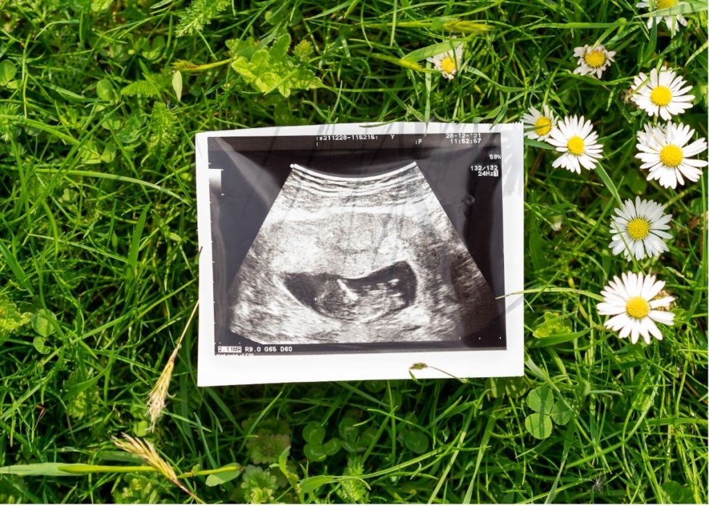 An ultrasound on the grass outside next to spring flowers.