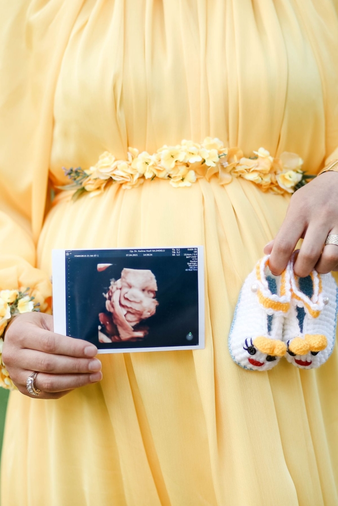 A woman in a spring dress holds up an ultrasound and baby booties.